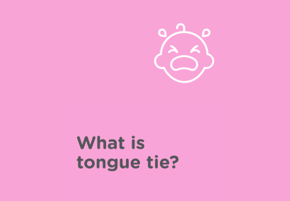 What is tongue tie? and crying baby icon
